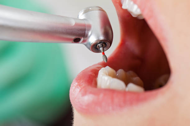 Best Dentist for Tooth Abscess  in Oregon, OH